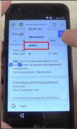 select assist